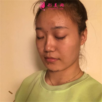 69da353c6001-half.png
