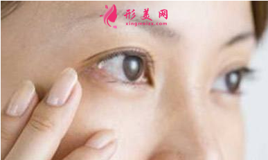眉眼小拉皮適合什么人群