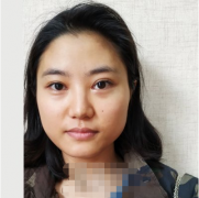 重慶軍美整形醫(yī)院口碑怎么樣？隆鼻效果有保障嗎？