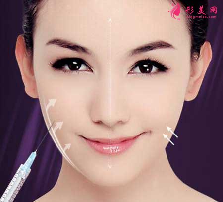 蘇州圣愛(ài)整形醫(yī)院做光子嫩膚