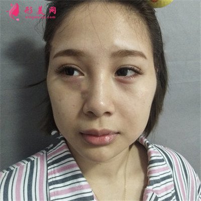 62372a1cf2cd-half.jpg