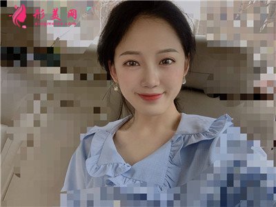 濟南鼻綜合術后恢復情況對比圖分享 術后 濟南鼻綜合術后恢復情況對比圖分享