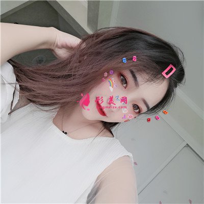 廈門全切雙眼皮術(shù)后案例效果分享 術(shù)后 廈門全切雙眼皮術(shù)后案例效果分享