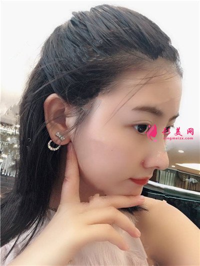 8c7b59bc78bf-audio.jpg