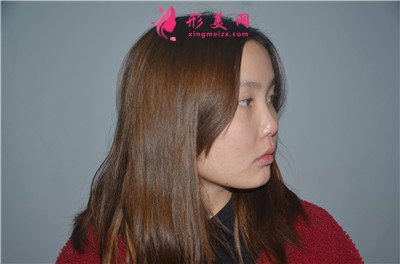 b81e7de78a77-audio.jpg