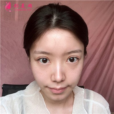 c243881764a6-audio.jpg