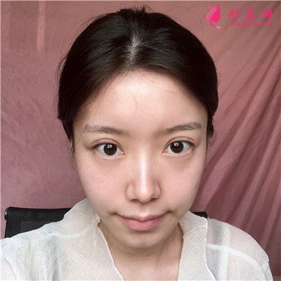 c243881764a6-audio.jpg