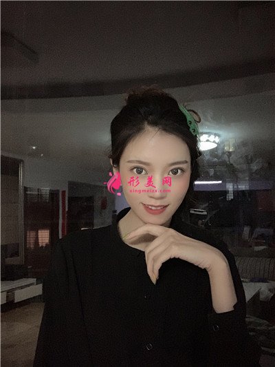河南面部埋線提升術(shù)后效果分享 術(shù)后 河南面部埋線提升術(shù)后效果分享
