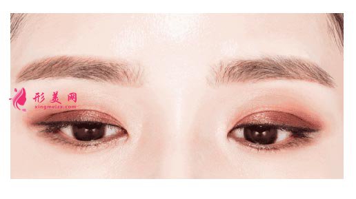 埋線雙眼皮術(shù)后能化妝嗎