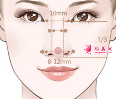 鼻翼縮小手術(shù)疤痕明顯嗎
