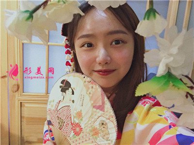 成都小姐姐種植發(fā)際線手術(shù)術(shù)后效果分享 術(shù)后 成都小姐姐種植發(fā)際線手術(shù)術(shù)后效果分享