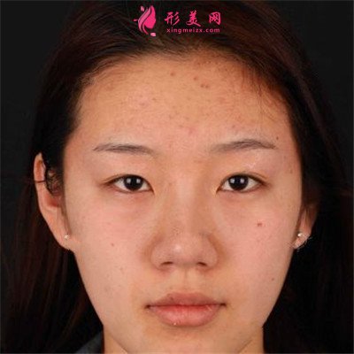 8799c78092db-half.jpg 8799c78092db-half.jpg