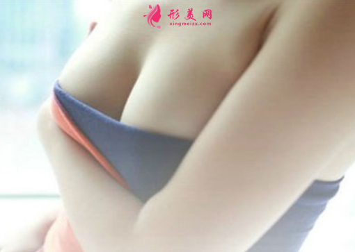 假體隆胸大概多久恢復(fù)好