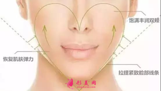 自體脂肪填充臉部可以保持多少年