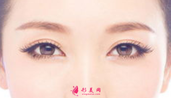 全切雙眼皮的費(fèi)用是多少