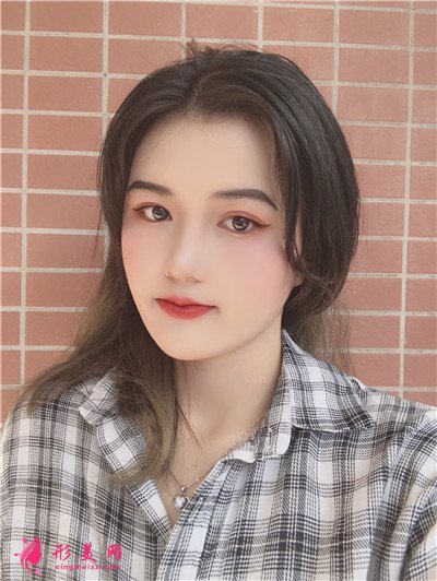 深圳全切雙眼皮術(shù)后恢復(fù)效果對比圖分享 術(shù)后 深圳全切雙眼皮術(shù)后恢復(fù)效果對比圖分享