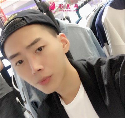 福州小哥哥鼻綜合術后恢復效果反饋 術后 福州小哥哥鼻綜合術后恢復效果反饋