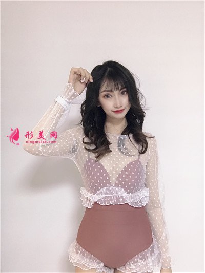 武漢全切雙眼皮術(shù)后恢復(fù)效果展示 術(shù)后 武漢全切雙眼皮術(shù)后恢復(fù)效果展示