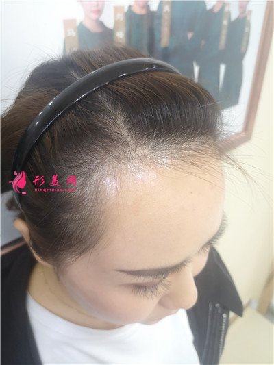7bc9623bbf8a-audio.jpg
