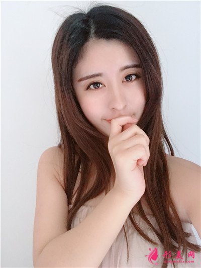 成都小仙女鼻綜合手術(shù)術(shù)后案例反饋 術(shù)后 成都小仙女鼻綜合手術(shù)術(shù)后案例反饋