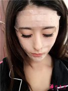 四川華人醫(yī)聯(lián)整形美容醫(yī)院小仙女鼻綜合手術(shù)術(shù)后案例反饋