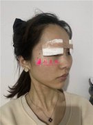 昆明市第一人民醫(yī)院星耀醫(yī)院眼部多項手術(shù)術(shù)后效果對比