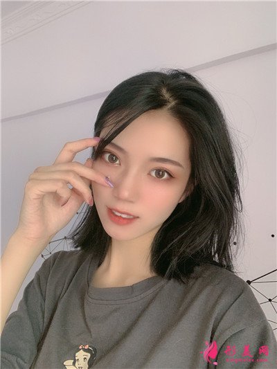 烏魯木齊眼綜合術(shù)后案例反饋 術(shù)后 烏魯木齊眼綜合術(shù)后案例反饋