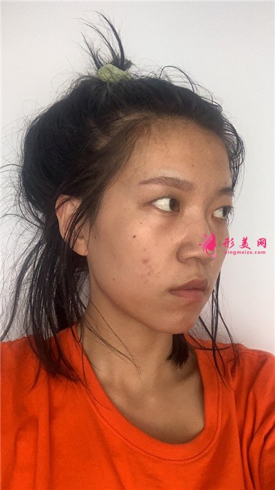 38d7a9ce8655-audio.jpg