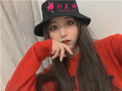 昆明小姐姐眼綜合手術(shù)術(shù)后案例分享 術(shù)后 昆明小姐姐眼綜合手術(shù)術(shù)后案例分享