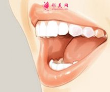 牙齒隱形矯正過程痛嗎？