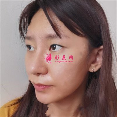 3090c2c1b48c-half.jpg