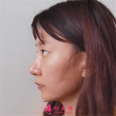 55f9a92184b0-half.jpg