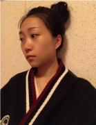 馮斌自體脂肪填充貴嗎？填充術(shù)后真人案例分享