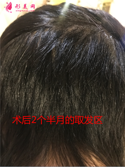 55a11d23108d-audio.png