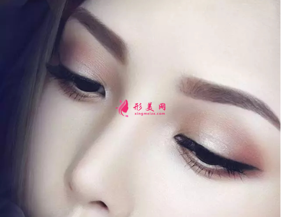 自體軟骨隆鼻的原理和優(yōu)勢