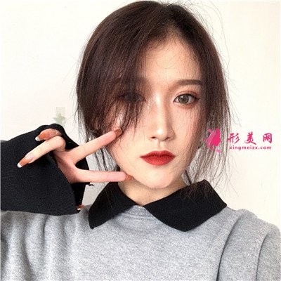 武漢小仙女全切雙眼皮術(shù)后恢復(fù)情況反饋 術(shù)后 武漢小仙女全切雙眼皮術(shù)后恢復(fù)情況反饋