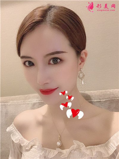 93f935773c15-audio.jpg