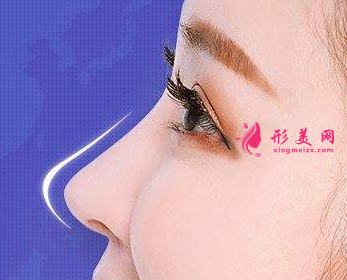 自體軟骨隆鼻后有沒有后遺癥