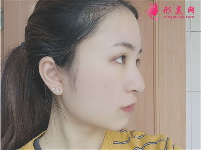 33d52074d2b4-audio.jpg