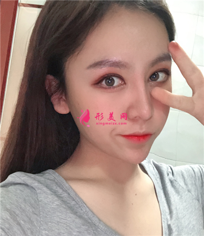 0617171ed73e-audio.png