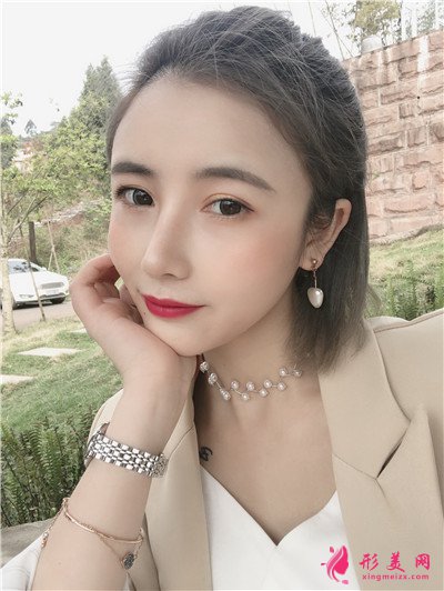 鄭州鼻綜合術(shù)后恢復(fù)效果對比圖反饋 術(shù)后 鄭州鼻綜合術(shù)后恢復(fù)效果對比圖反饋