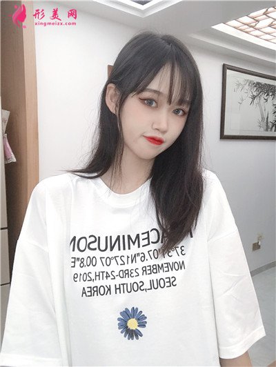 湖南小姐姐吸脂瘦臉術后效果反饋 術后 湖南小姐姐吸脂瘦臉術后效果反饋