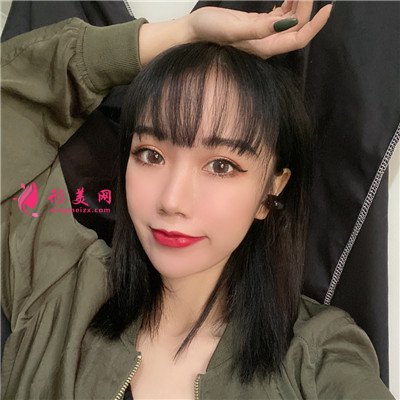 蘇州小姐姐全切雙眼皮術(shù)后效果對比 術(shù)后 蘇州小姐姐全切雙眼皮術(shù)后效果對比