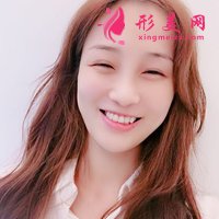 自體脂肪活細胞除皺真實體驗分享