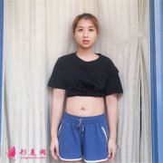 鄭州大學第二附屬醫(yī)院腰腹吸脂手術術后效果反饋