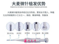 大麥微針植發(fā)靠譜嗎？微針植發(fā)恢復過程日記