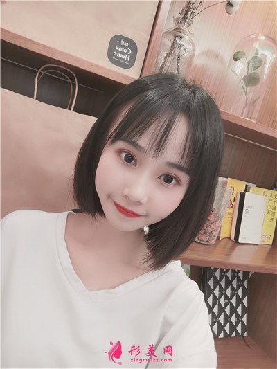 武漢小仙女眼部綜合術(shù)后恢復(fù)情況分享 術(shù)后 武漢小仙女眼部綜合術(shù)后恢復(fù)情況分享