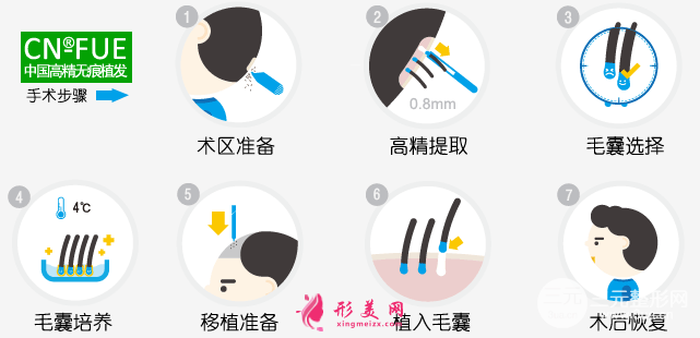 上海九院植發(fā)價(jià)格