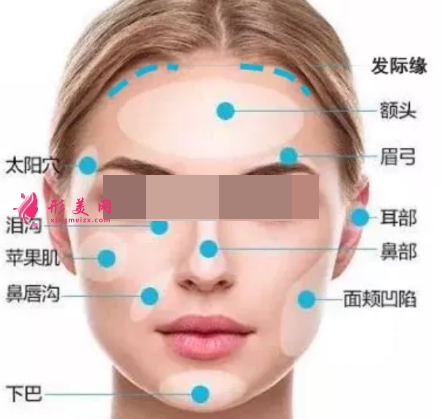 自體脂肪填充臉部多久恢復(fù)自然
