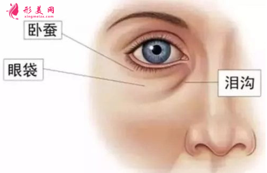 手術(shù)祛眼袋后可以化妝嗎